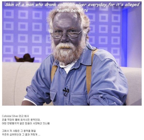 17 은에 중독된 사람.jpg