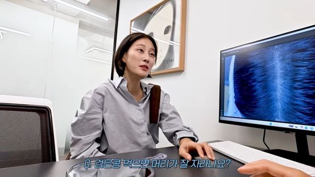 이현이 모발 이식 | 출처 유튜브 〈워킹맘 이현이〉