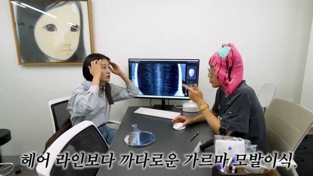 이현이 모발 이식 | 출처 유튜브 〈워킹맘 이현이〉