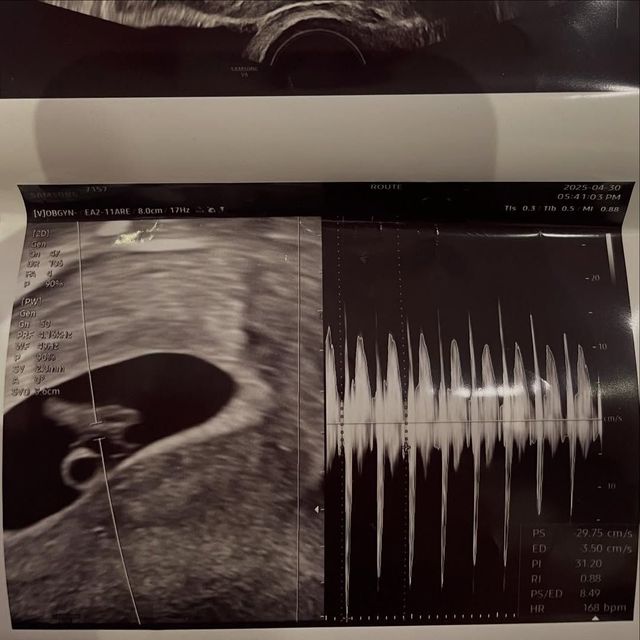 인스타그램 @seominjae_71