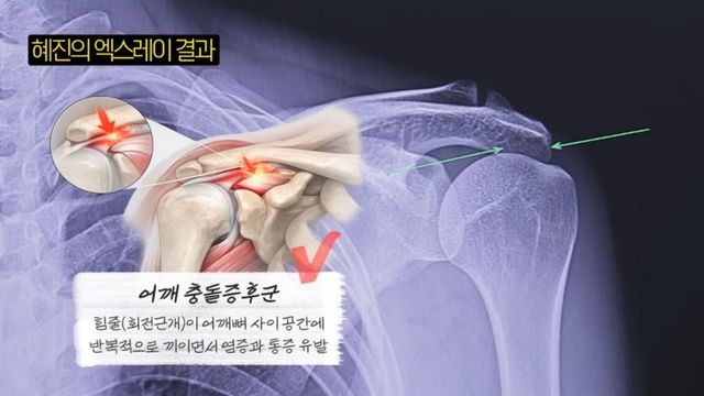 한혜진 거북목 교정 | 출처 유튜브 〈한혜진〉