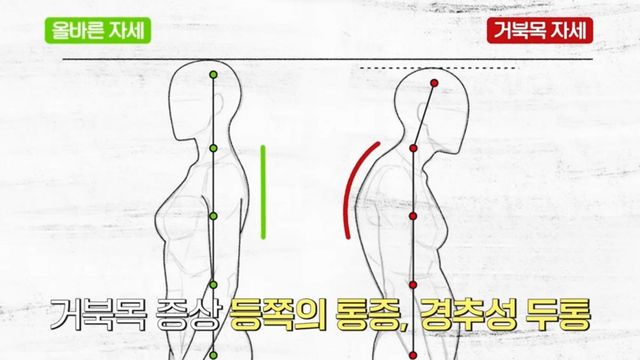 한혜진 거북목 교정 | 출처 유튜브 〈한혜진〉