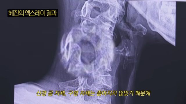 한혜진 거북목 교정 | 출처 유튜브 〈한혜진〉