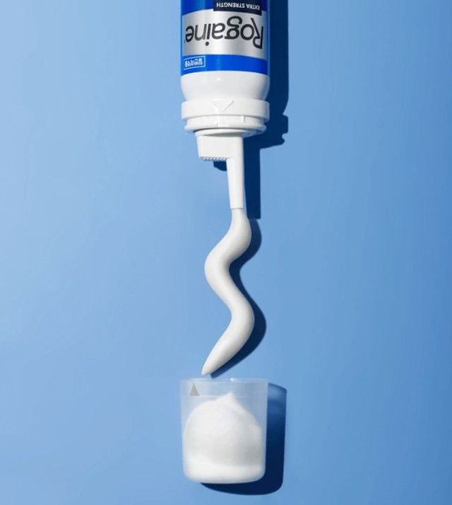 탈모의 골든타임 / 출처: 로게인 공식 홈페이지