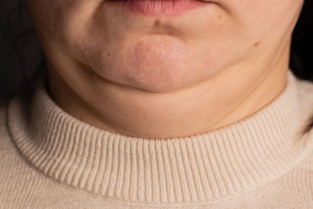 출처: 게티이미지