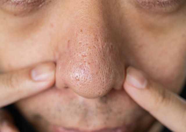 출처: 게티이미지