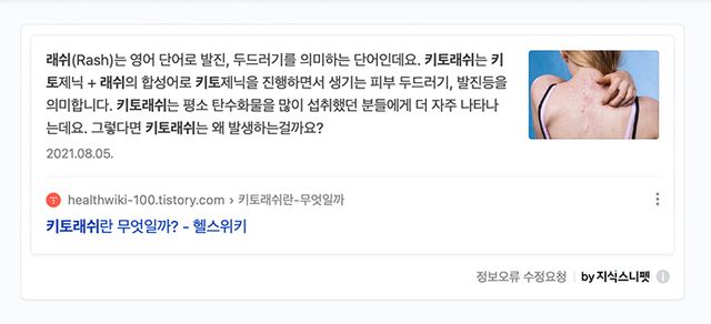 색소성 양진이란?