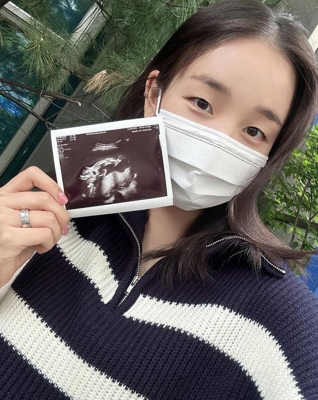 사진=백아연 인스타그램