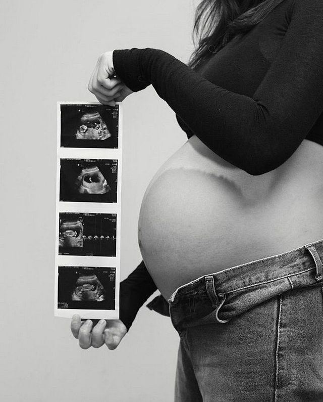 사진=가수 소야 인스타그램