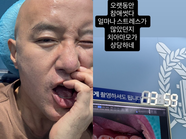 홍석천 소셜 캡처
