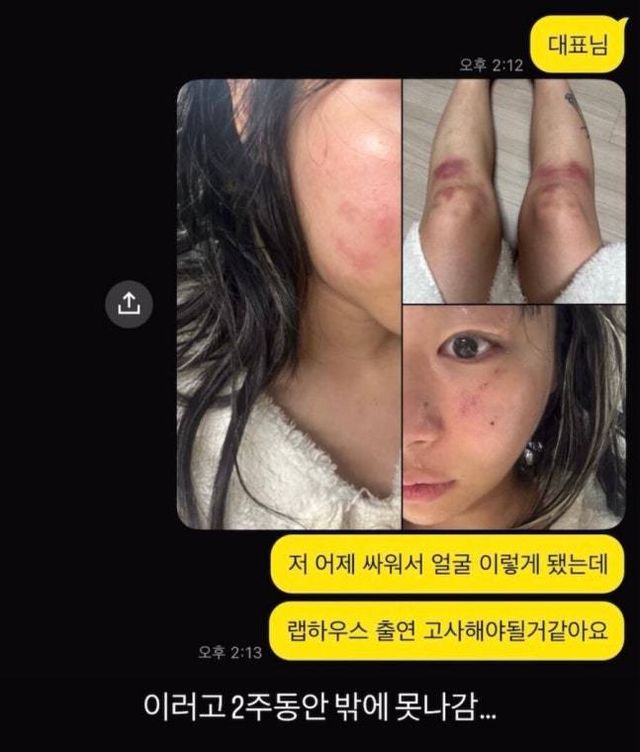 재키와이 SNS 캡처