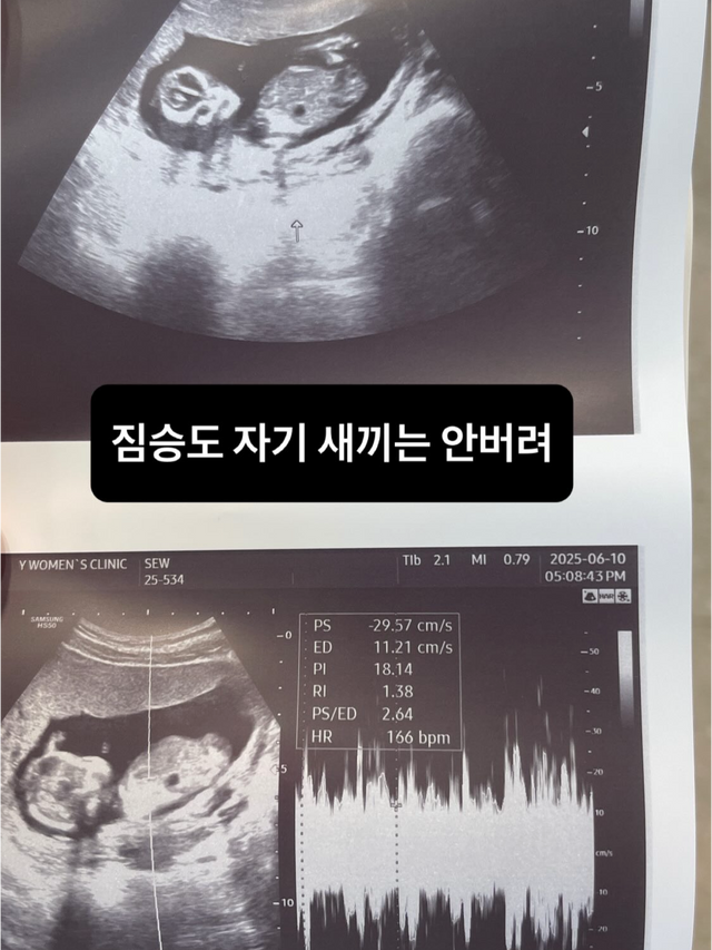 서민재 소셜 캡처