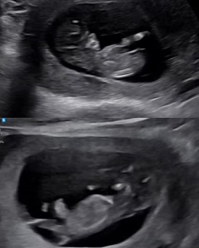 임라라 소셜 캡처