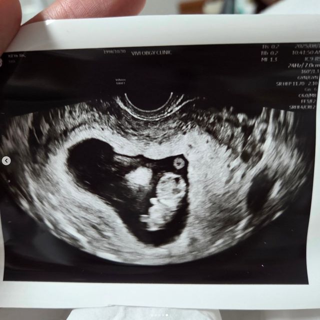 사진 ｜김동재 인스타그램