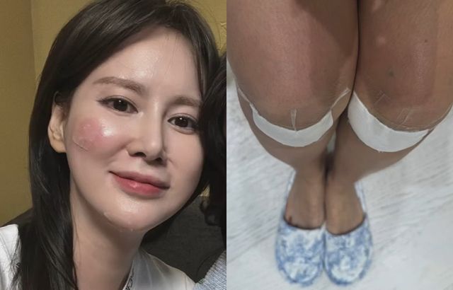 사진=이혜원 인스타그램