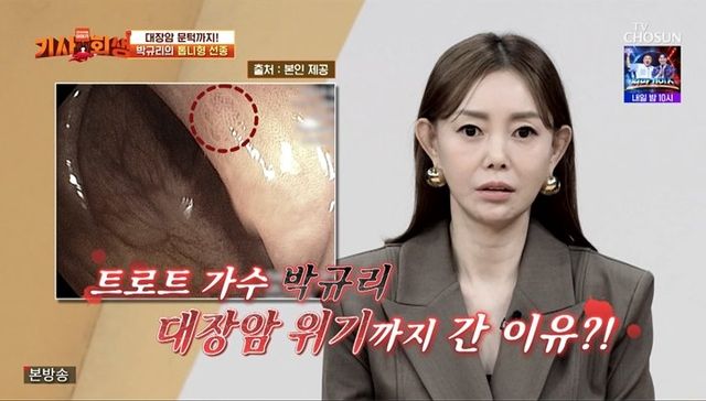 사진제공 | TV조선