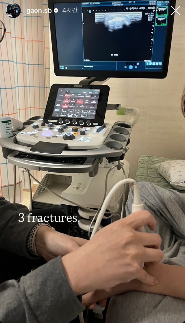 최가온이 19일 자신의 SNS에 병원에서 검진을 받는 사진과 함께 “3 fractures(골절)”라고 적었다. 귀국 후 검진 결과 골절이 발견된 것으로 관측된다. 사진출처｜최가온 SNS 캡처