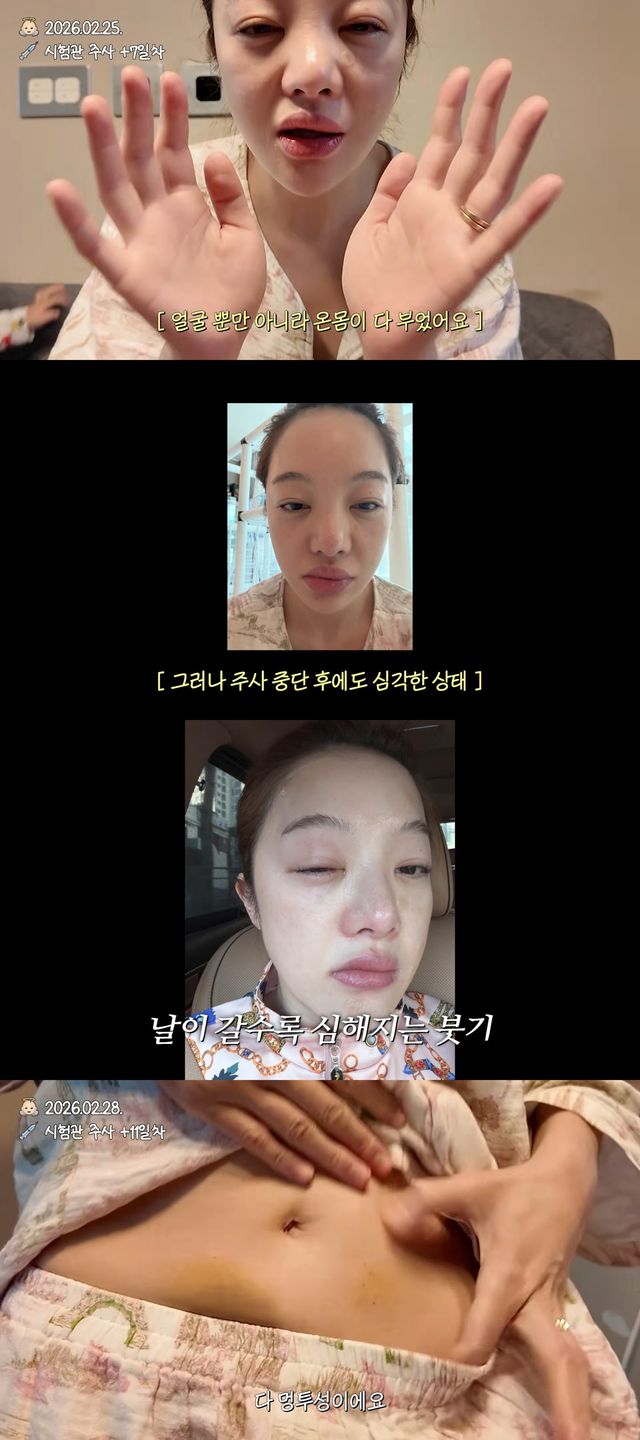 사진=유튜브 채널 ‘황보라 보라이어티’