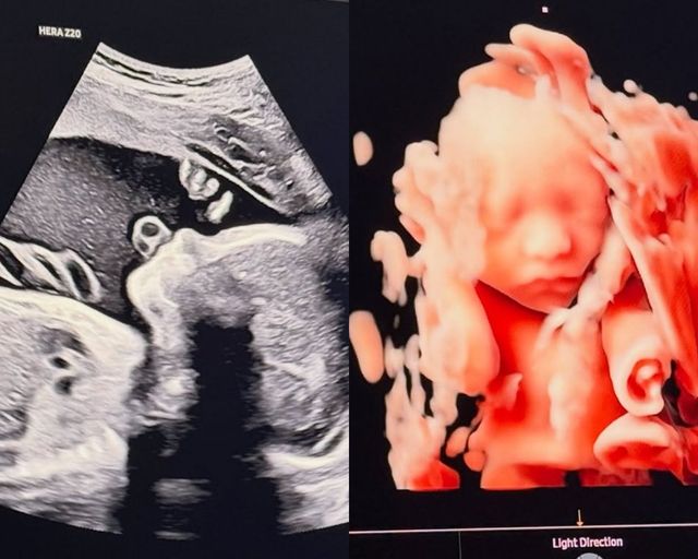 사진=송승현 SNS