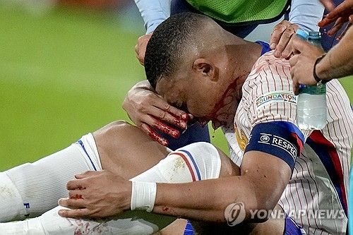 프랑스 간판스타 킬리안 음바페가 18일 유럽축구연맹(UEFA) 2024 유럽축구선수권대회(유로 2024) 오스트리아전에서 코뼈가 골절되는 중상을 입은 가운데, 그가 수술을 하지 않고 마스크를 쓰기로 해서 새 소속팀 레알 마드리드가 속을 태우고 있다. 하루 빨리 수술하고 완치 해야 2024-2025시즌 초반부터 기용할 수 있는데 음바페가 수술을 미루고 유로 2024 전 경기를 뛰기로 해서다. 음바페는 법적으로도 6월30일까지는 PSG 선수여서 레알이 할 수 있는 게 없다. 연합뉴스