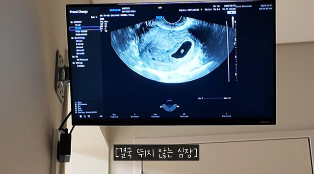 유튜브 채널 '로부부'