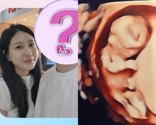 28기 정숙이 임신했다 