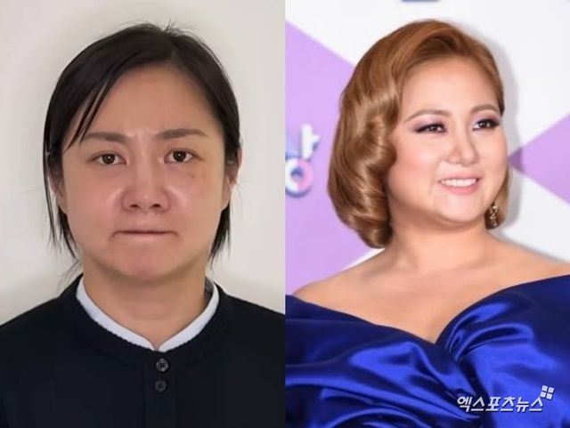 사진 = 유튜브 채널 '백은영의 골든타임'. 엑스포츠뉴스 DB