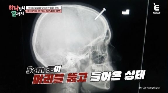 사진= 티캐스트 E채널 '하나부터 열까지'