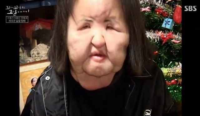 SBS '꼬리에 꼬리를 무는 이야기' 캡처