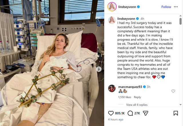 미국 알파인 스키의 '리빙 레전드' 린지 본이 2026 동계올림픽 여자 활강 경기 도중 당한 왼쪽 정강이뼈(경골) 복합 골절 이후 12일(한국시간) 자신의 사회관계망서비스(SNS) 인스타그램 게시글로 근황을 전했다. 본은 게시물에서 '나는 회복 중이고, 속도는 느리지만 결국 괜찮아질 거라는 걸 안다'며 재활 의지를 숨기지 않았다. 또 '곁을 지켜준 의료진, 친구, 가족, 그리고 전 세계에서 보내준 사랑과 응원에 감사하다. 나에게 응원할 무언가를 주는 대표팀 동료들과 미국 선수들에게도 큰 축하를 보낸다'고 적었다. 린지 본 SNS