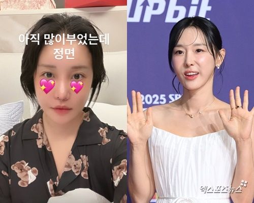 랄랄, 이지혜 