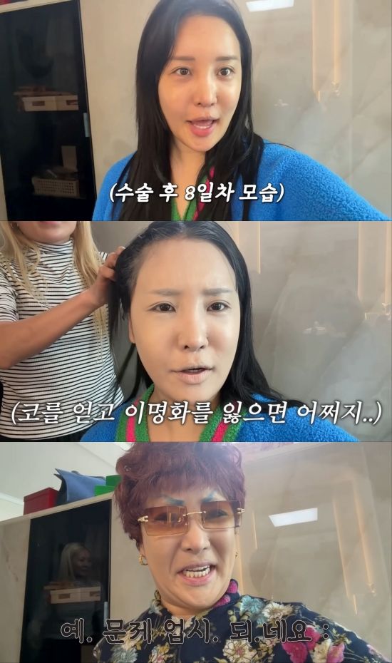 랄랄, 성형수술 후 부캐 '이명화' 분장