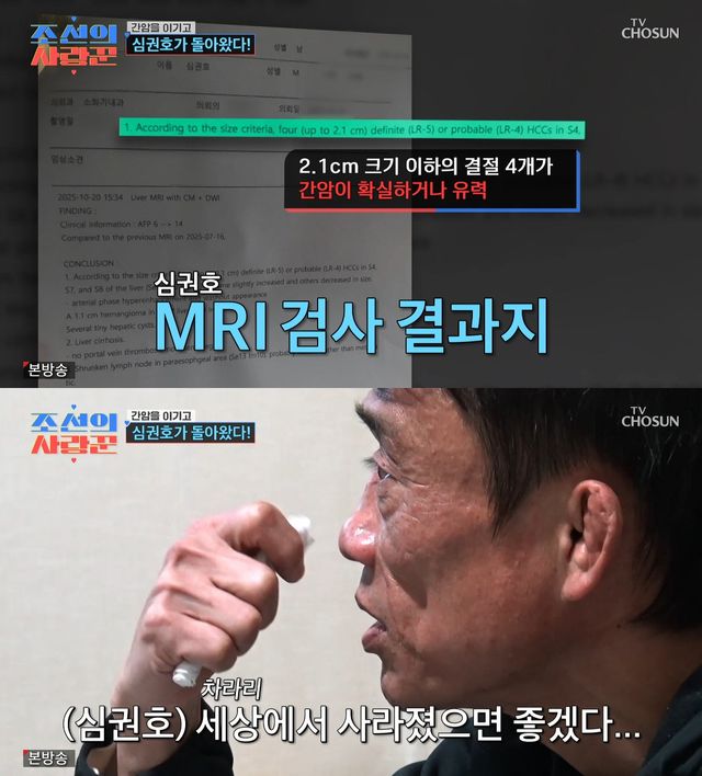 사진= TV조선 '조선의 사랑꾼'