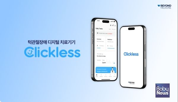 ‘비욘드 메디슨 클릭리스’ 제품 홍보 사진. ⓒ비욘드메디슨