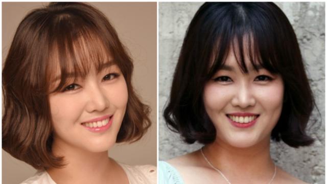 정미애 나이 결혼 남편 자녀 나이차이 설암 때문에 혀를 절제…