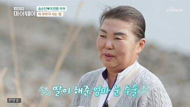 송가인 母 눈 처져서 아프다고 했더니 딸이 성형외과 예약…부기 안 빠져 마이웨이