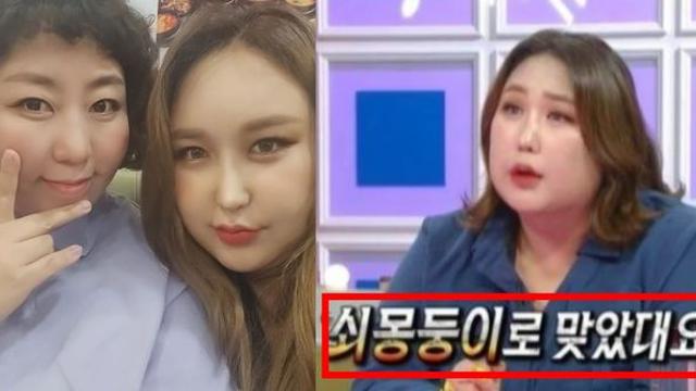 신기루, 쇠몽둥이로 목 가격당해 병원행… 신기루의 뒷목을 가격한 쇠몽둥이의 정체내용
