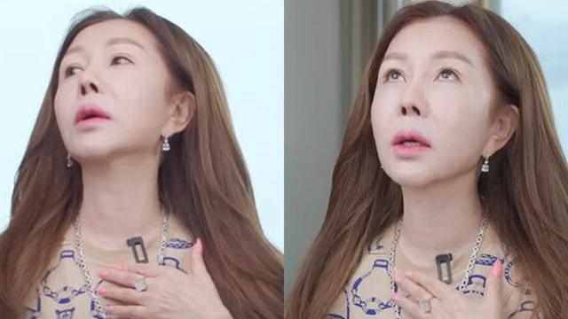 박준금, 50만원대 목주름 시술 후기 만족도 90, 효과는
