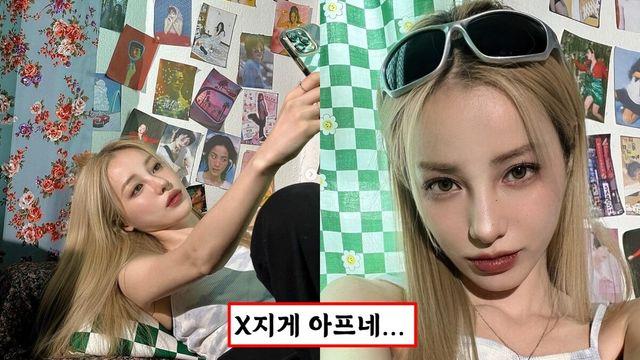 X지게 아프네… 유깻잎 이번에는 볼 패임 없애는 수술 받아…