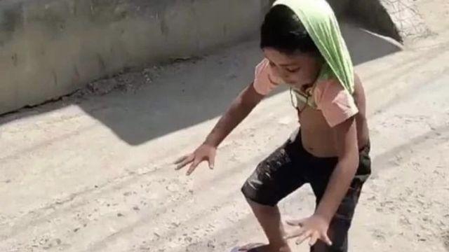 개구리 그림자
