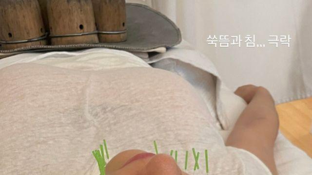 옥주현, 얼굴에 침 수십 개 꽂고도 세상 평온한 표정 깜짝