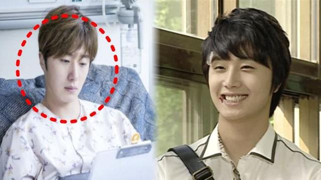 언제 죽을지 몰라…배우 정일우, 뇌동맥류 발병 10년 뒤 근황 안타까운 고백