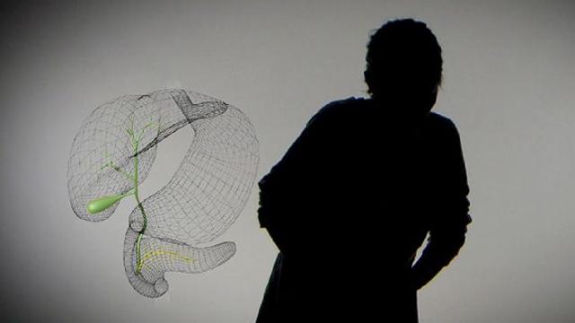 명의 소화불량으로 소화제만 먹었었는데…담도∙담낭 질환