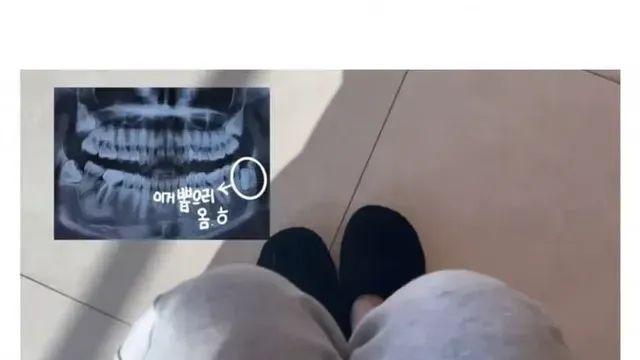 사랑님 뽑고 의사가 하지 말라는거 다 한 여자.jpg