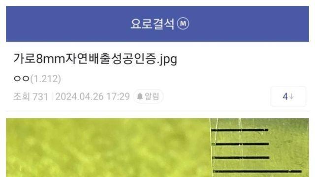 요로결석 자연배출 성공한 디씨인