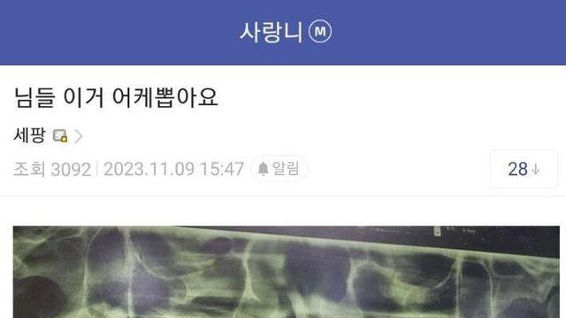 사랑니갤러리 새 갤주.jpg