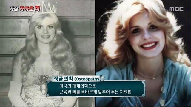 아내에게 성형수술 강요하고 수술 후 약물 과다복용으로 살해한 남편