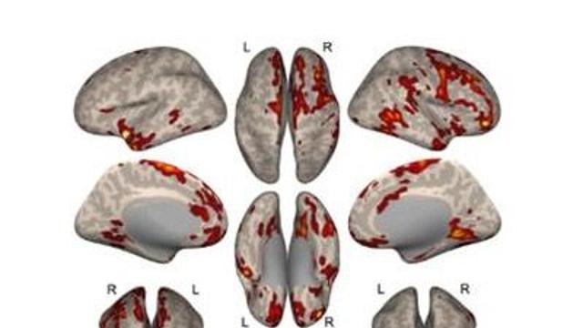ADHD 아동의 뇌 기능 변화, 만 7~8세 사이에 집중적으로 발생