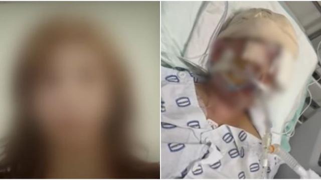 식당·콜센터 등 고생만 하며 남매 키워온 싱글맘, 남친 무차별 폭행에 혼수상태