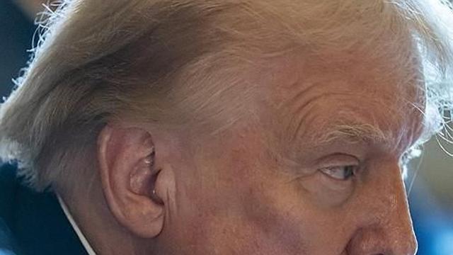 총알 아닌 파편?…'귀에 거즈붕대 뗀' 트럼프에 총알 피격 논란
